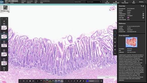 HALO AP Dx brings digital primary diagnosis to anatomic pathology labs in the US
