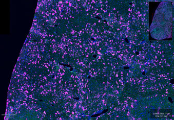 Immunofluorescence microscopy of transgenic mouse liver constitutively expressing a GFP fusion protein using JIR A