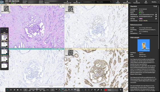 The intuitive user interface of HALO AP®, localized here in German, provides pathologists with an integrated view of each case